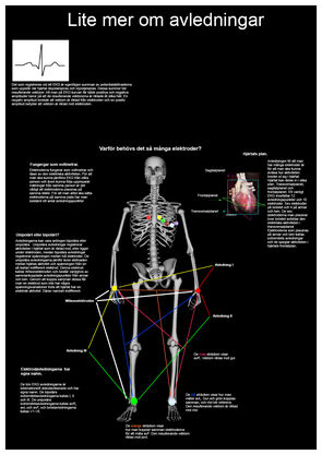 EKG - Poster 2 (pdf 109 kB, ny flik).