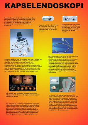 Capsule endoscopy - Poster (pdf 2.13 MB, new tab, in Swedish).