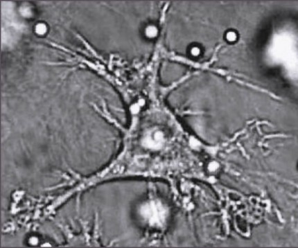 Dendritcell. Foto: Wikipedia commons.