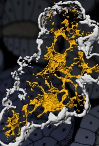 Bild: Cellerna i en bukspottkörtel som färgats med immunoflourescens. 